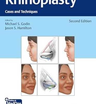 خرید و دانلود کتاب Rhinoplasty: Cases and Techniques 2nd Edition + Video