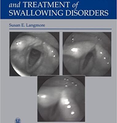 Endoscopic Evaluation and Treatment of Swallowing Disorders (2nd Edition)