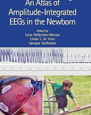 An Atlas of Amplitude-Integrated EEGs in the Newborn (3rd Edition) - Orginal Pdf