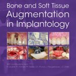 خرید و دانلود دانلود کتاب Bone and Soft Tissue Augmentation in Implantology