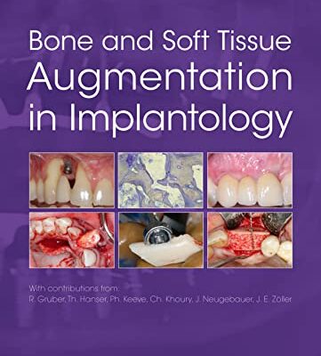خرید و دانلود دانلود کتاب Bone and Soft Tissue Augmentation in Implantology