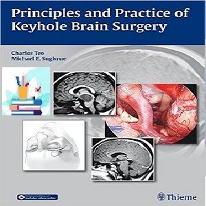 خرید و دانلود Principles and Practice of Keyhole Brain Surgery