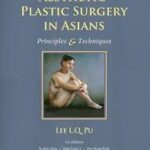 Aesthetic Plastic Surgery in Asians: Principles and Techniques