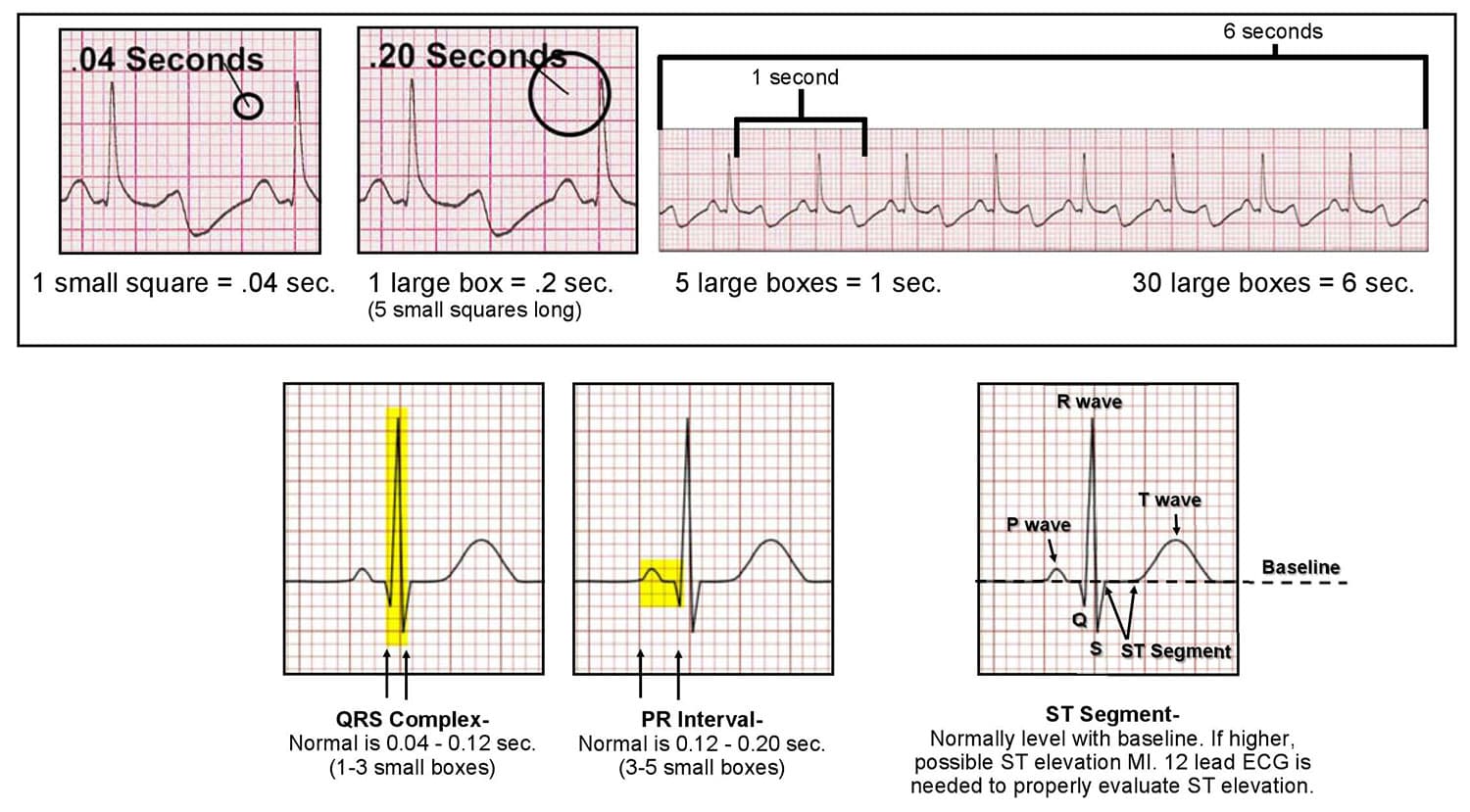 تفسیر-ECG خرید و دانلود جزوه تفسیر ECG برای پرستاران - تصویر 1