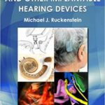 خرید و دانلود نسخه کامل کتاب Cochlear Implants and Other Implantable Hearing Devices by Michael J. Ruckenstein   –  PDF