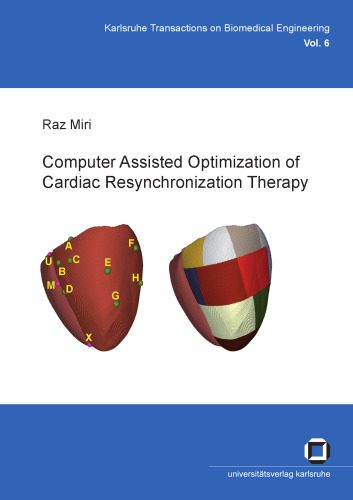خرید و دانلود نسخه کامل کتاب Computer assisted optimization of cardiac resynchronization therapy_685efd3c5a269.jpeg خرید و دانلود نسخه کامل کتاب Computer assisted optimization of cardiac resynchronization therapy