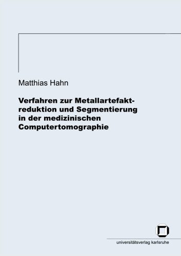 خرید و دانلود نسخه کامل کتاب Verfahren zur Metallartefaktreduktion und Segmentierung in der medizinischen Computertomographie German_6860dd07b5ab3.jpeg خرید و دانلود نسخه کامل کتاب Verfahren zur Metallartefaktreduktion und Segmentierung in der medizinischen Computertomographie German