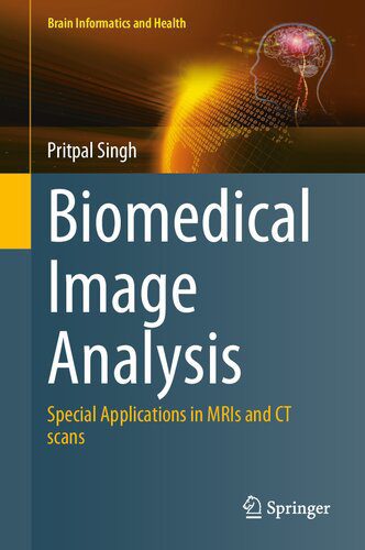خرید و دانلود نسخه کامل کتاب Biomedical Image Analysis: Special Applications in MRIs and CT scans_6865a841459e0.jpeg خرید و دانلود نسخه کامل کتاب Biomedical Image Analysis: Special Applications in MRIs and CT scans