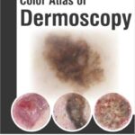 خرید و دانلود نسخه کامل کتاب Colour Atlas of Dermoscopy