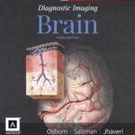 خرید و دانلود نسخه کامل کتاب Diagnostic Imaging: Brain