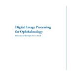 خرید و دانلود نسخه کامل کتاب Digital Image Processing for Ophthalmology: Detection of the Optic Nerve Head