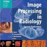 خرید و دانلود نسخه کامل کتاب Image Processing in Radiology Current Applications