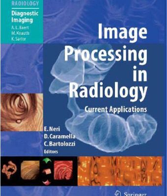 خرید و دانلود نسخه کامل کتاب Image Processing in Radiology Current Applications
