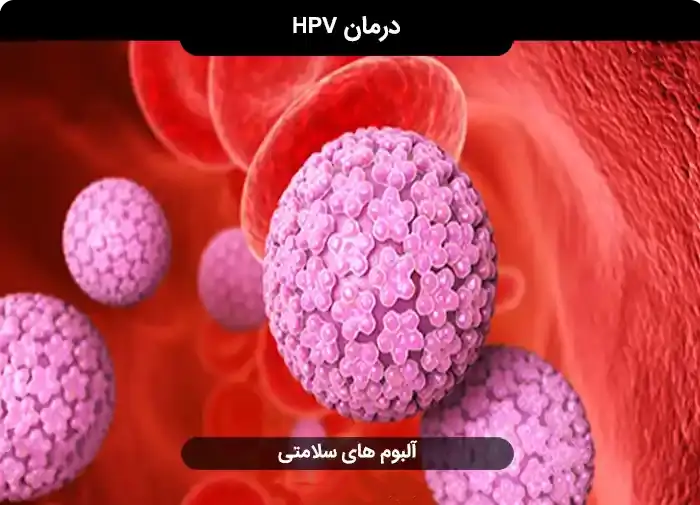 خرید-و-دانلود-فایل-پاکسازی-ویروس-hpv-از-بدن-درمان-اچ-پی-وی- خرید و دانلود نسخه کامل فایل پاکسازی ویروس hpv از بدن ( درمان اچ پی وی ) | میکی بوک - تصویر 1