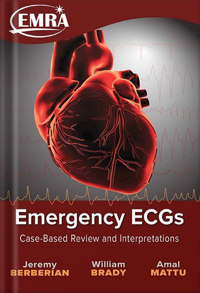 225-New-PNG-Version-101-3.jpg خرید و دانلود نسخه کامل کتاب Emergency ECGs: Case-Based Review and Interpretations by Jeremy Berberian PDF - تصویر 1